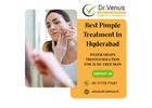 Best Pimple Treatment Near Me | Dr. Venus